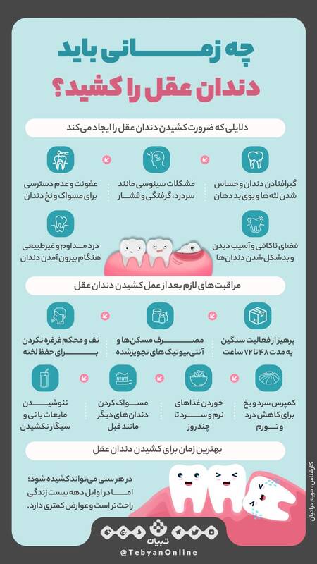 چه زمانی باید دندان عقل را کشید؟ 2