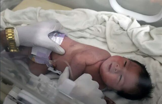 آیا، نوزاد متولدشده در زیرآوار زلزله مهیب ترکیه و سوریه