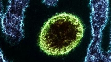 شیوع یک ویروس جدید در چین ؛ چقدر باید از لانگیا بترسیم؟